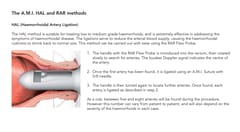 AMI® HAL / RAR-system