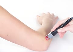 Pain Management Laser Handpiece Compatible with Lasotronix Laser
