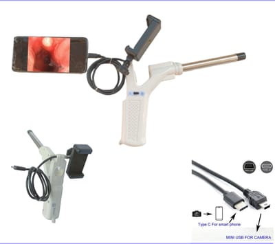 Suneye Pro-videoproctoscoop met USB-camera en biopsiekanaal