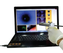 Video Proctoscope USB